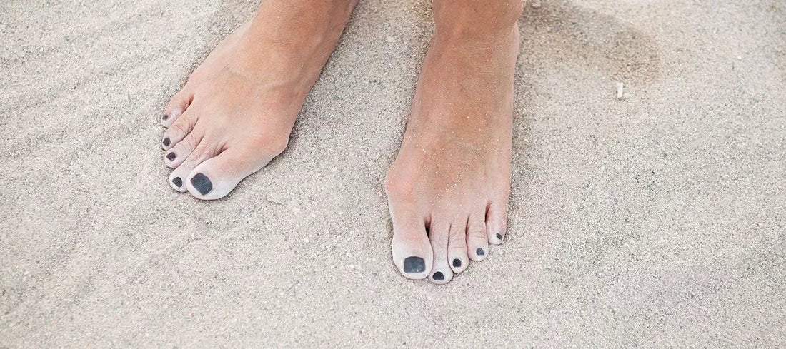 DER KOMFORT-SCHUH BEI HALLUX VALGUS